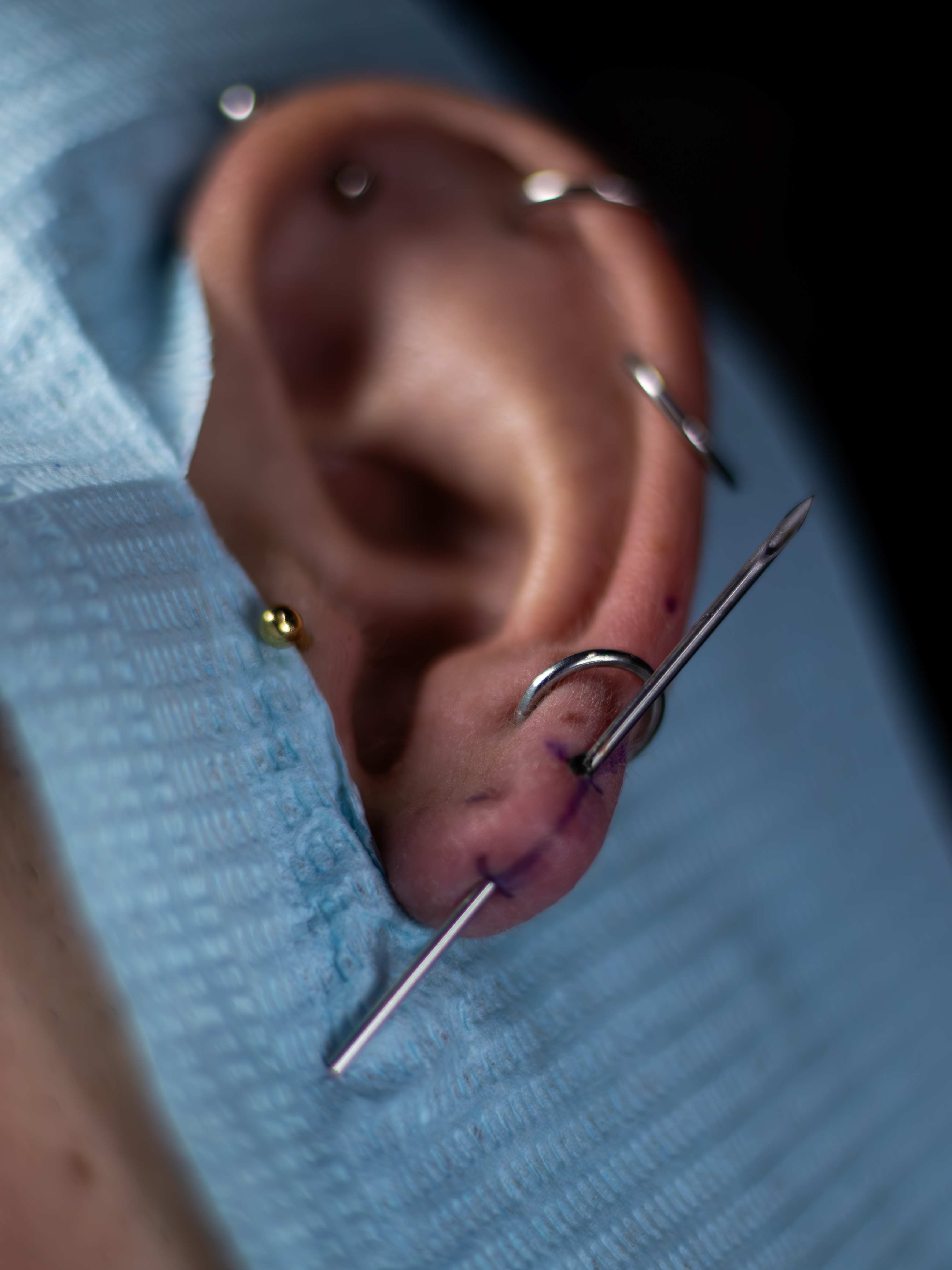 Piercing en lóbulo con aro metálico